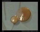 pseudomonas staphylococcus tsa